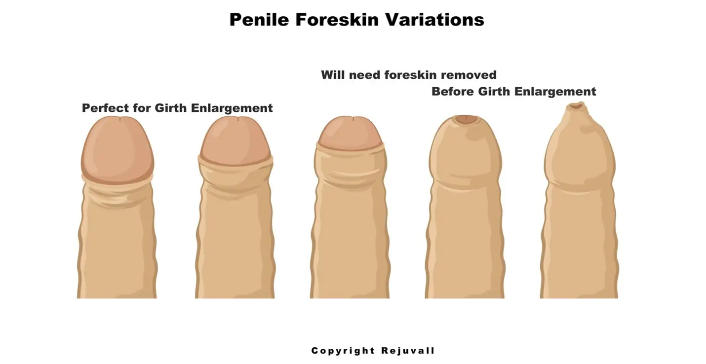 Is 6in Girth Above Average? Exploring Penis Girth Measurements