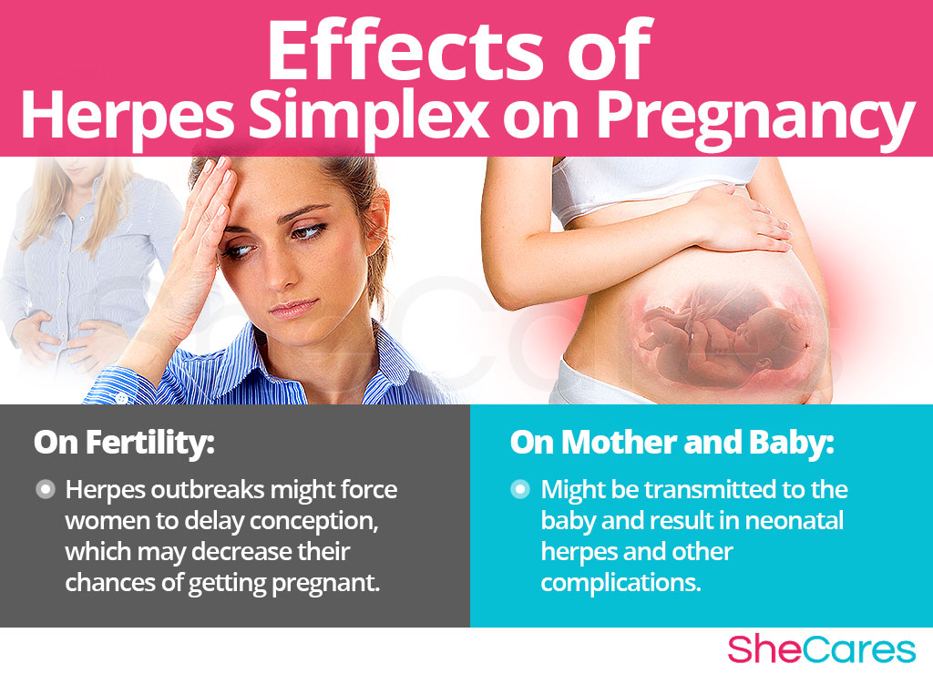 Herpes and Pregnancy: Does It Affect Your Chances of Having a Baby?