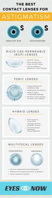Best Contacts for Astigmatism: Top Options and Reviews for Clear Vision