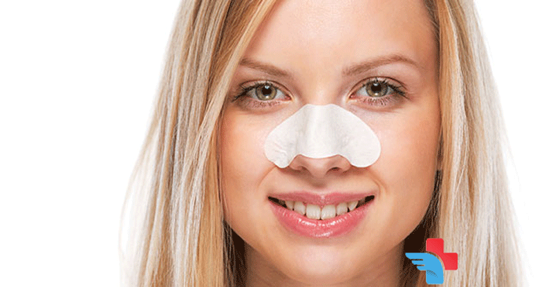 Nose Splint Falling Out: Causes, Solutions, and When to Seek Help