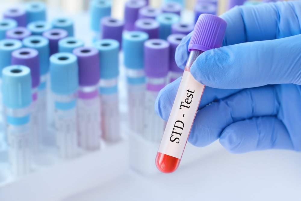 How Urgent Care Centers Provide STD Testing and Treatment