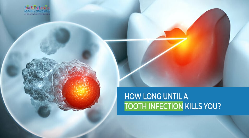 Understanding the Timeline： How Long Until a Tooth Infection Poses a Serious Risk？