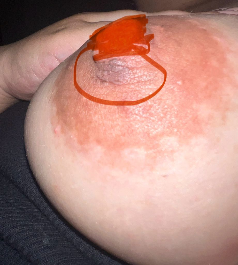 Pink Nipples During Pregnancy: What to Expect