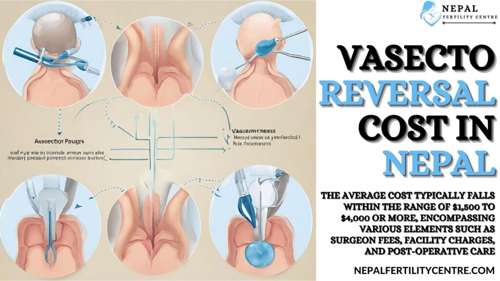 Out of Pocket Vasectomy Cost: What Factors Influence the Price, and How to Save.