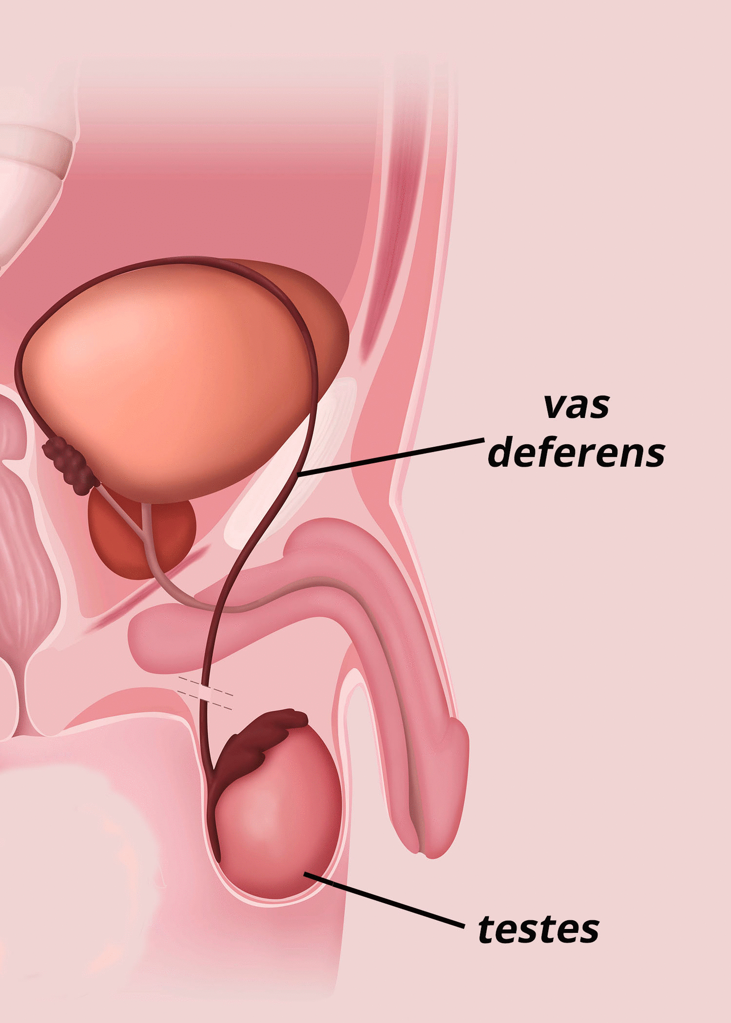 Unsure About Vasectomy Cost? Heres What You Need to Know