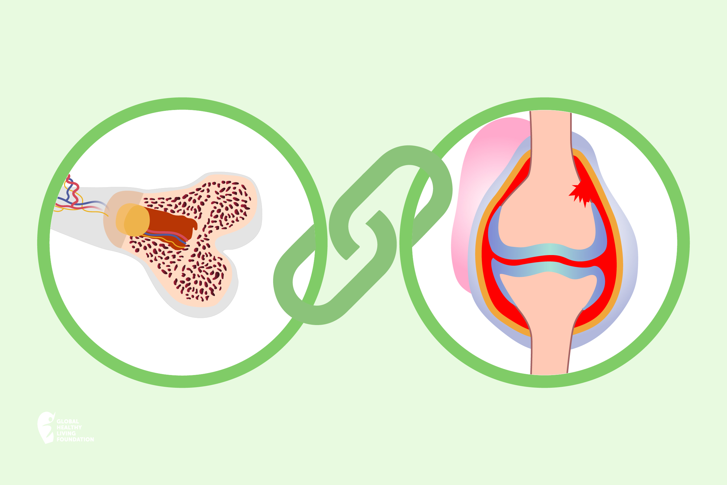 Prone Bone Problems? Heres What You Need to Know