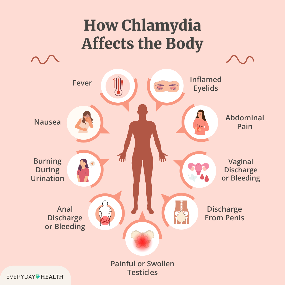 Chlamidioze symptoms: What to look out for?