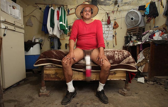How big is the biggest penis record? Prepare to be amazed!