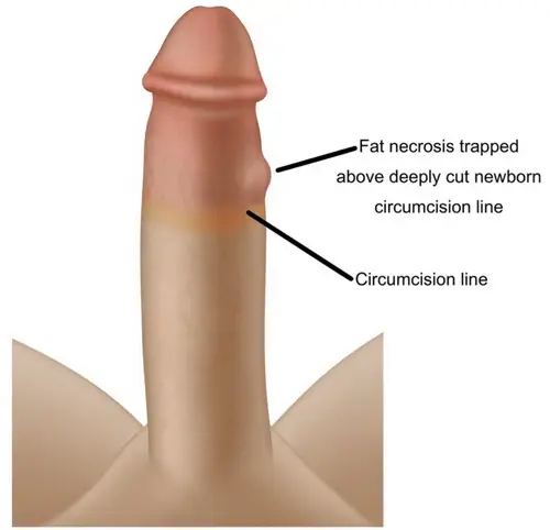 Exploring 6 Inch Penis Girth: Size, Averages, and Perceptions
