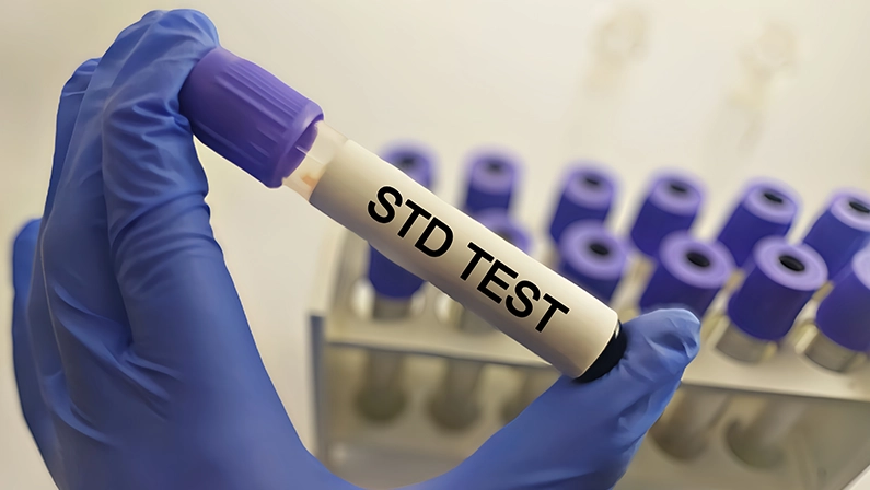 Fast & Discreet STD Tests: Does Urgent Care Do STD Screenings?