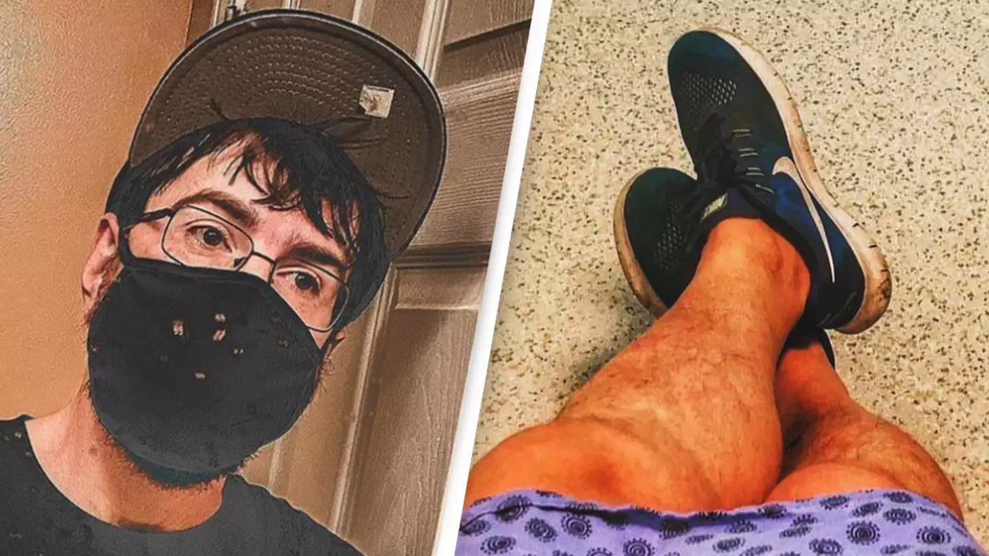 The Mystery of the Smallest Weiner in the World Revealed