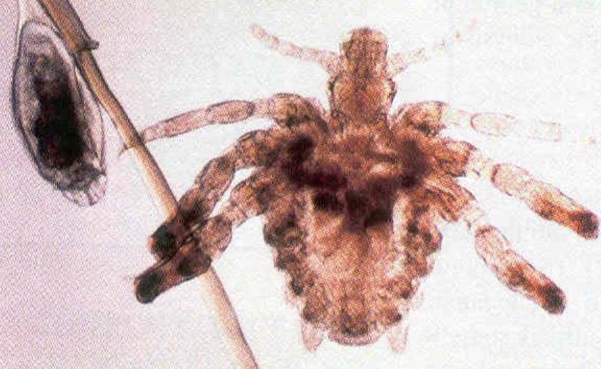 Can You Really See Crabs on a Toilet Seat? Lets Debunk This Myth!