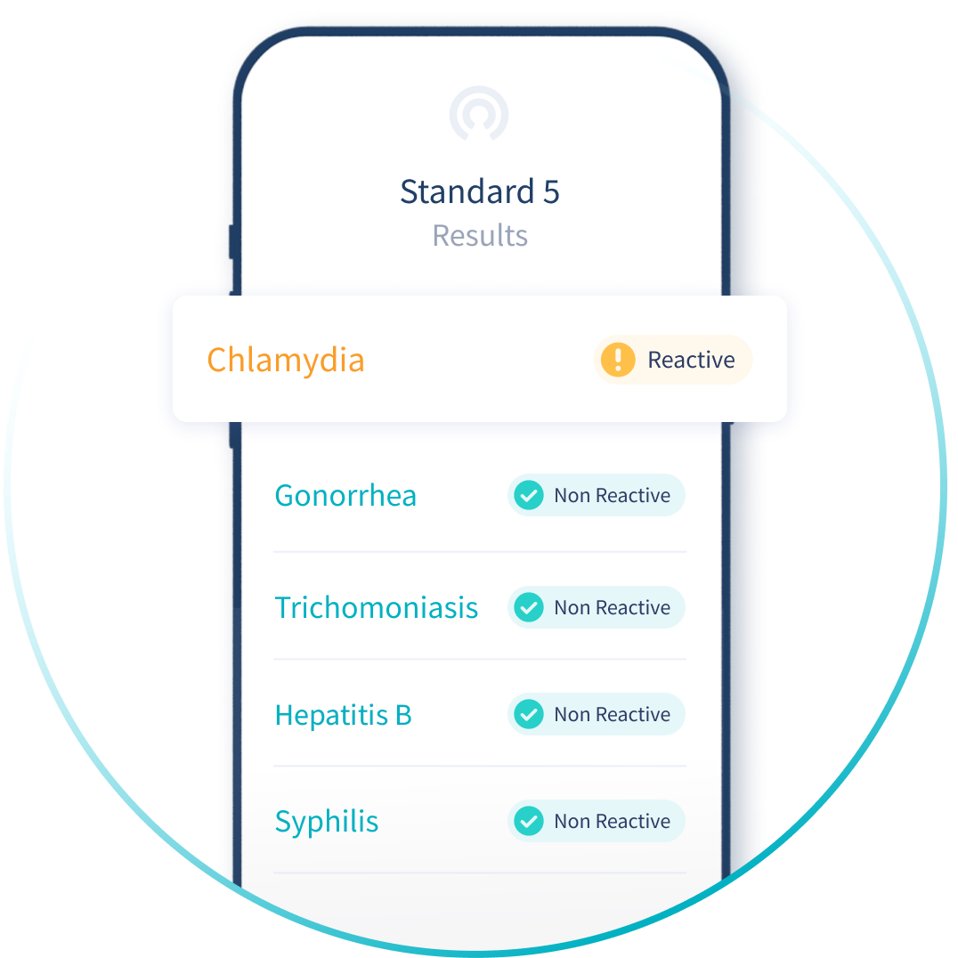 Trichomoniasis Testing Near Me: Your Guide to Local and Affordable Options