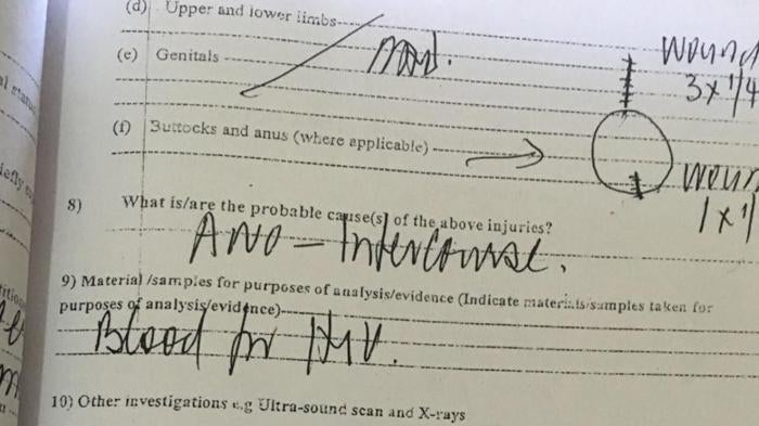 Anal Forced Porn: Understanding the Risks and Effects.