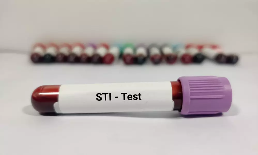Does Insurance Cover STD Testing at Urgent Care? Find Out Here!