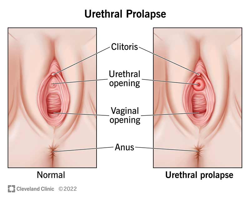 Need Help With What Hole Do You Put It In? Check This Out!