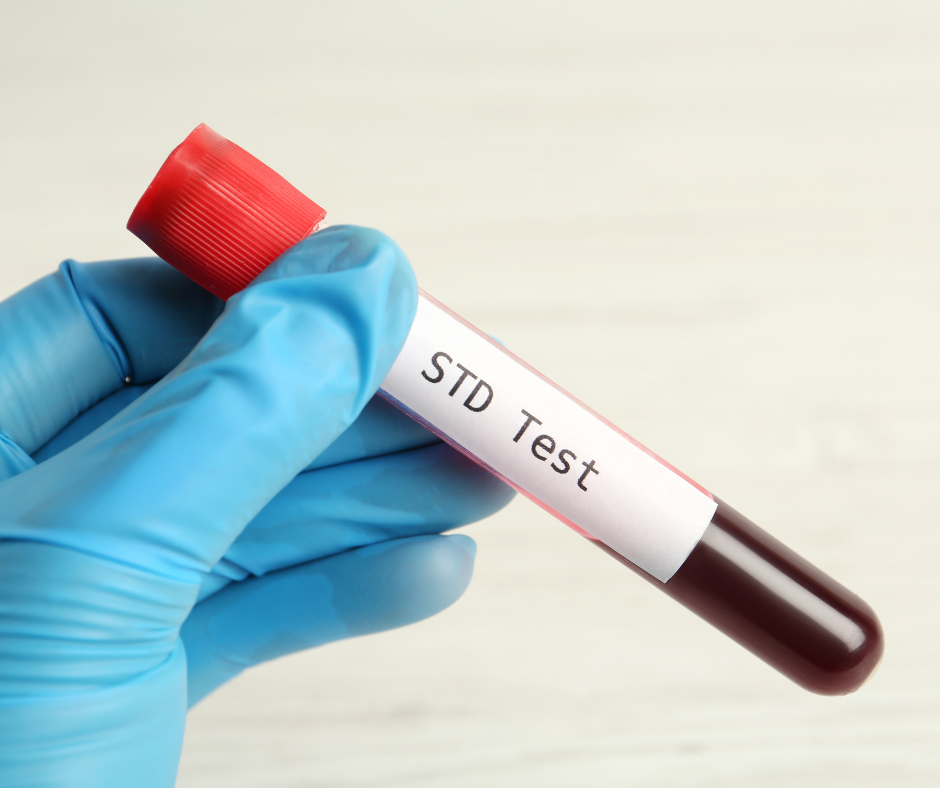 Will Urgent Care Do STD Tests? Find Out How to Get Checked Quickly and Discreetly!