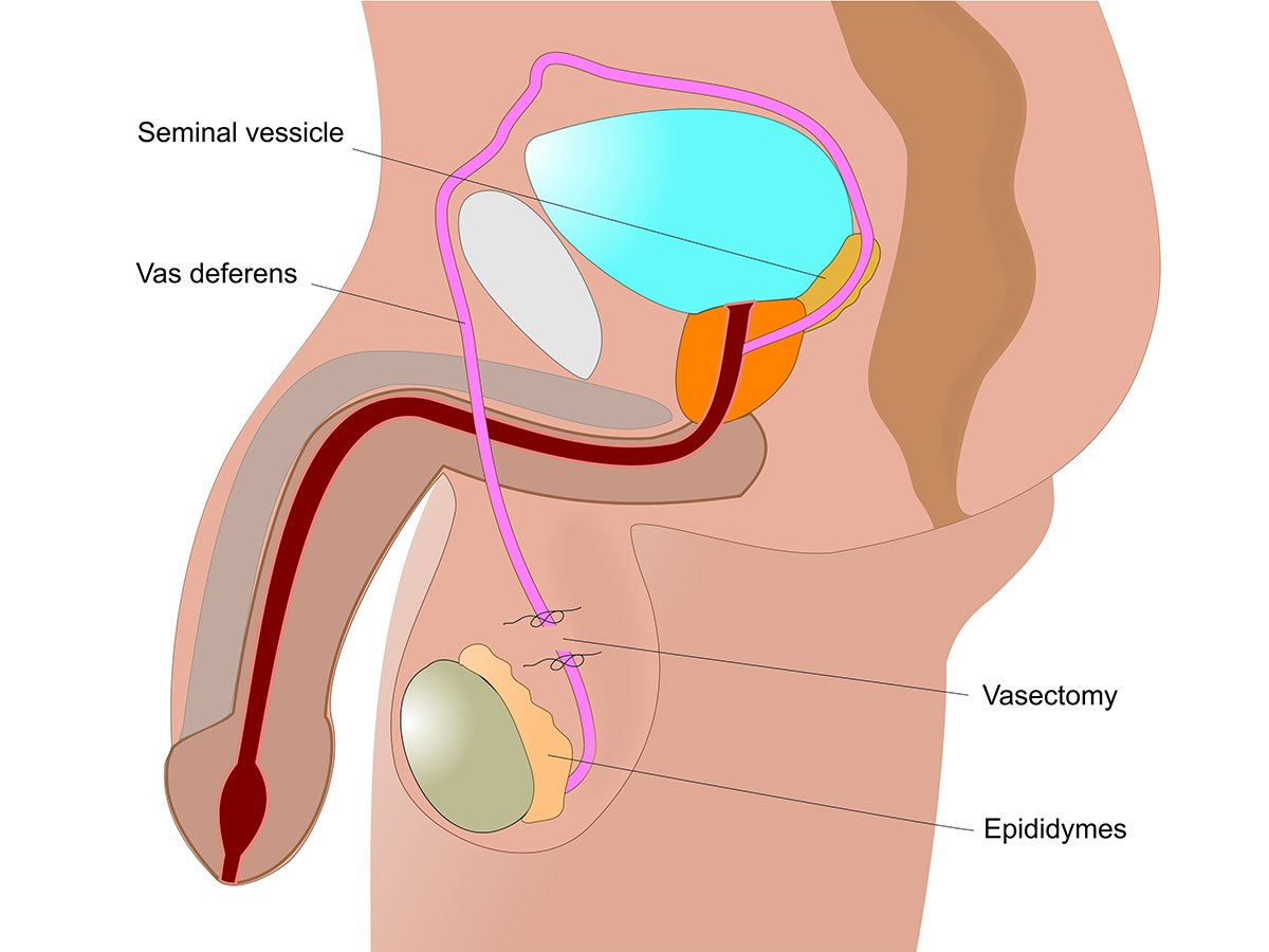 Vasectomy Appointment Near Me: Compare Prices and Find the Best Urologist Quickly in Your Location