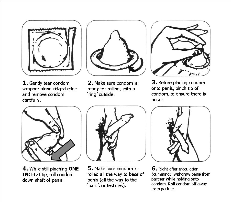 Condom Demonstration: How to Use One (Easy Steps for Safe Sex)