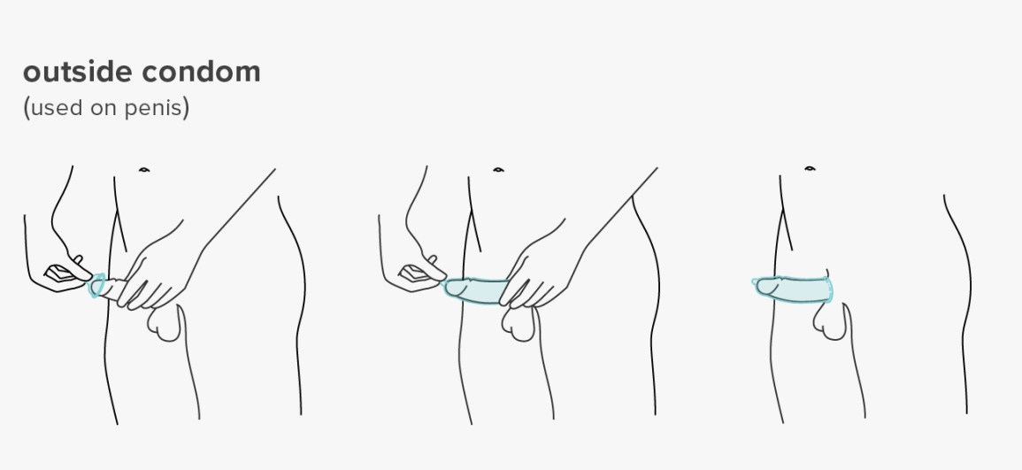 Mastering the Art of Putting Condom on Erect Penis