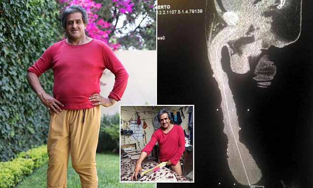 World Record for Largest Penis: Can You Guess The Size?