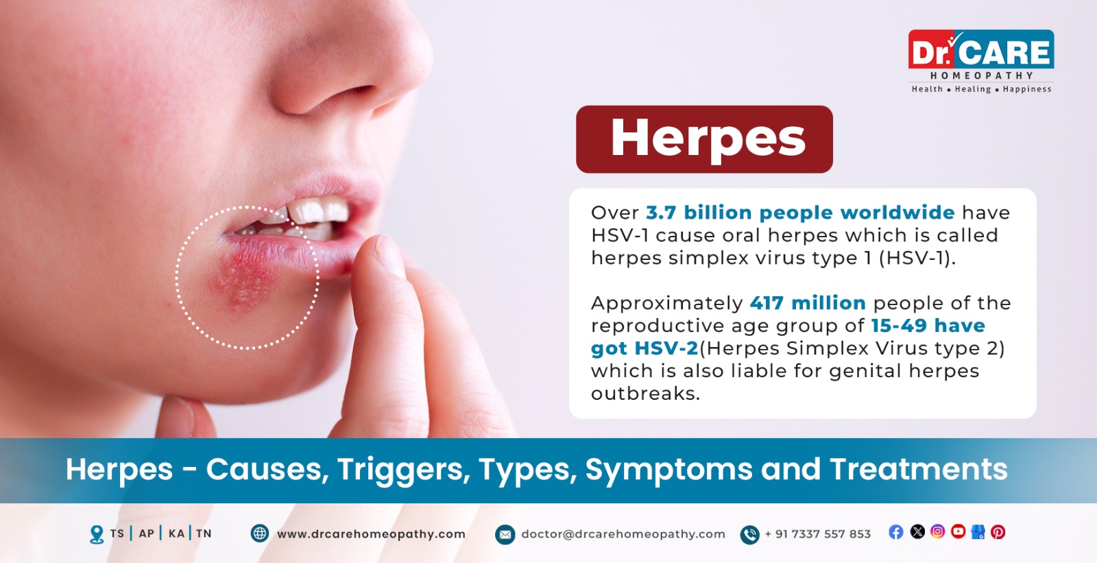 Dealing with Herpetic Hepatitis: What You Need to Know Explained