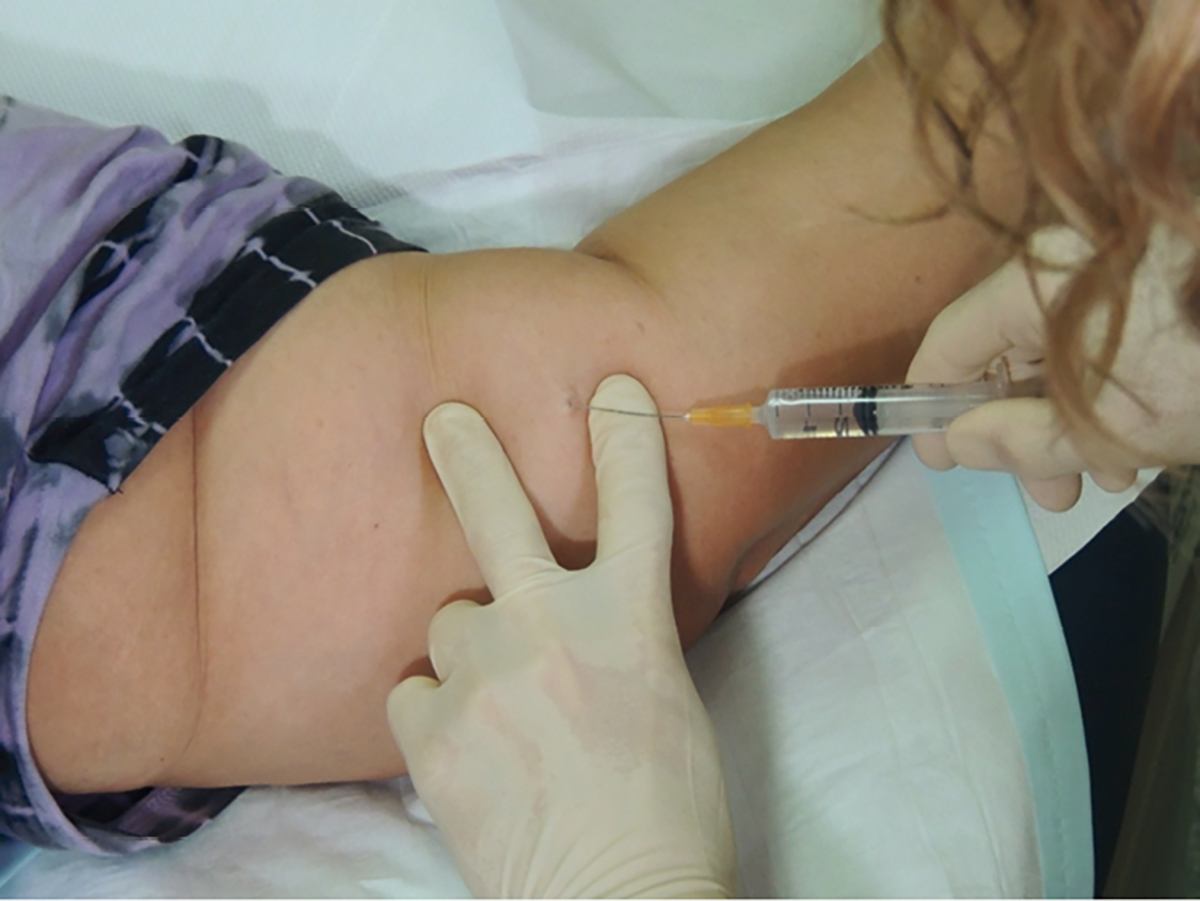 Starting Your First Period After Nexplanon Insertion: A Simple Guide for You