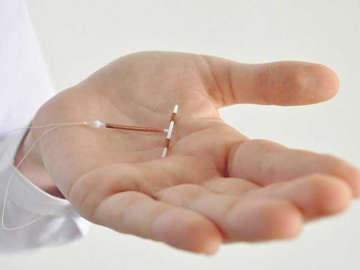 diu de mirena Fell Out: Common Causes and Prevention Tips for Next