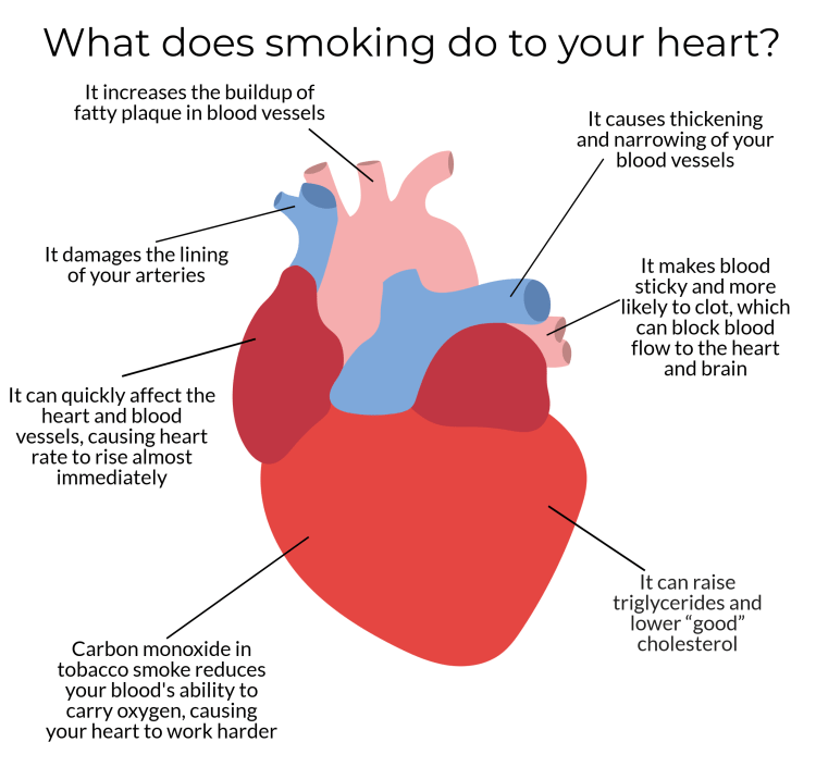 Love vs. Lungs: Ending a Relationship Because of Smoking, Making a Tough Choice