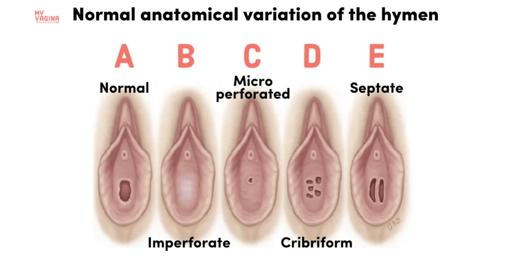 Open vaginas: find out how to recognize them quickly!