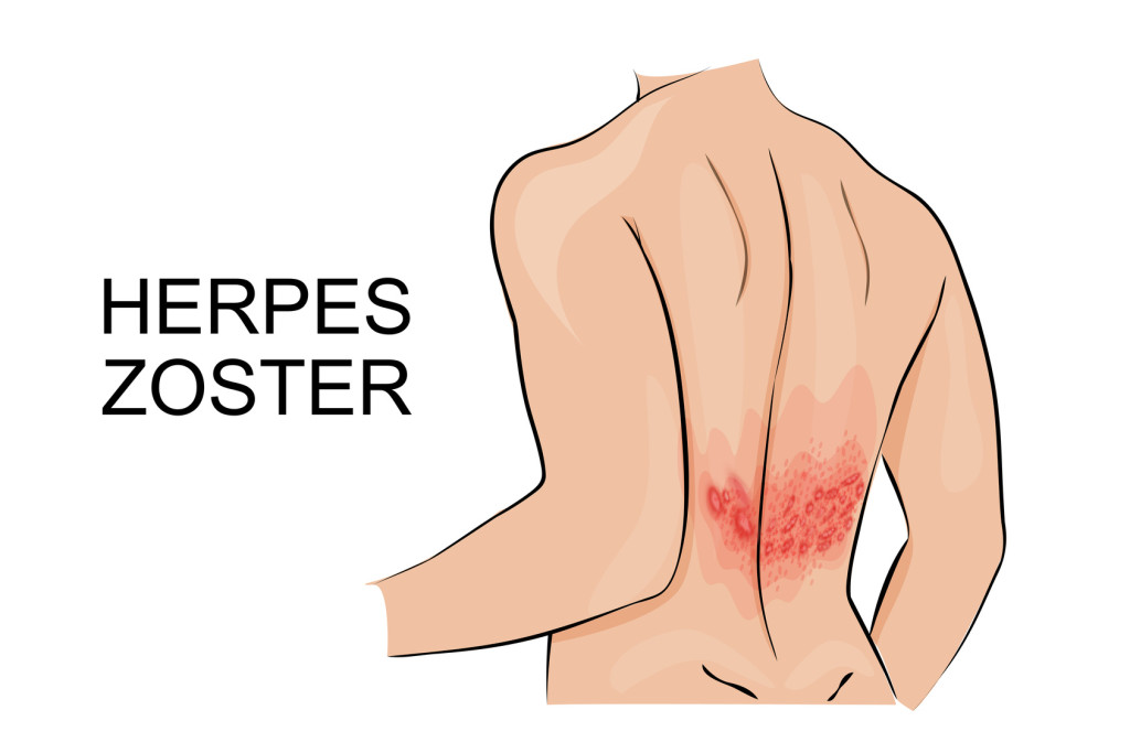 What is Zona Superficial? Simple Explanation for Beginners You Need to Know.
