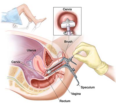 Pap Smear Cost Explained: Simple Tips to Reduce Expenses!