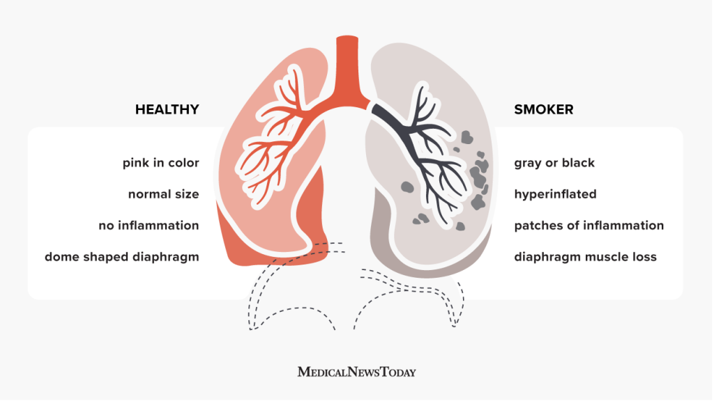 Love vs. Lungs: Ending a Relationship Because of Smoking, Making a Tough Choice