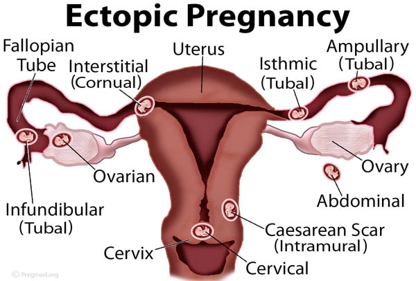 Does Imane Have Ovaries? Lets Clear Up the Confusion and Address This Question