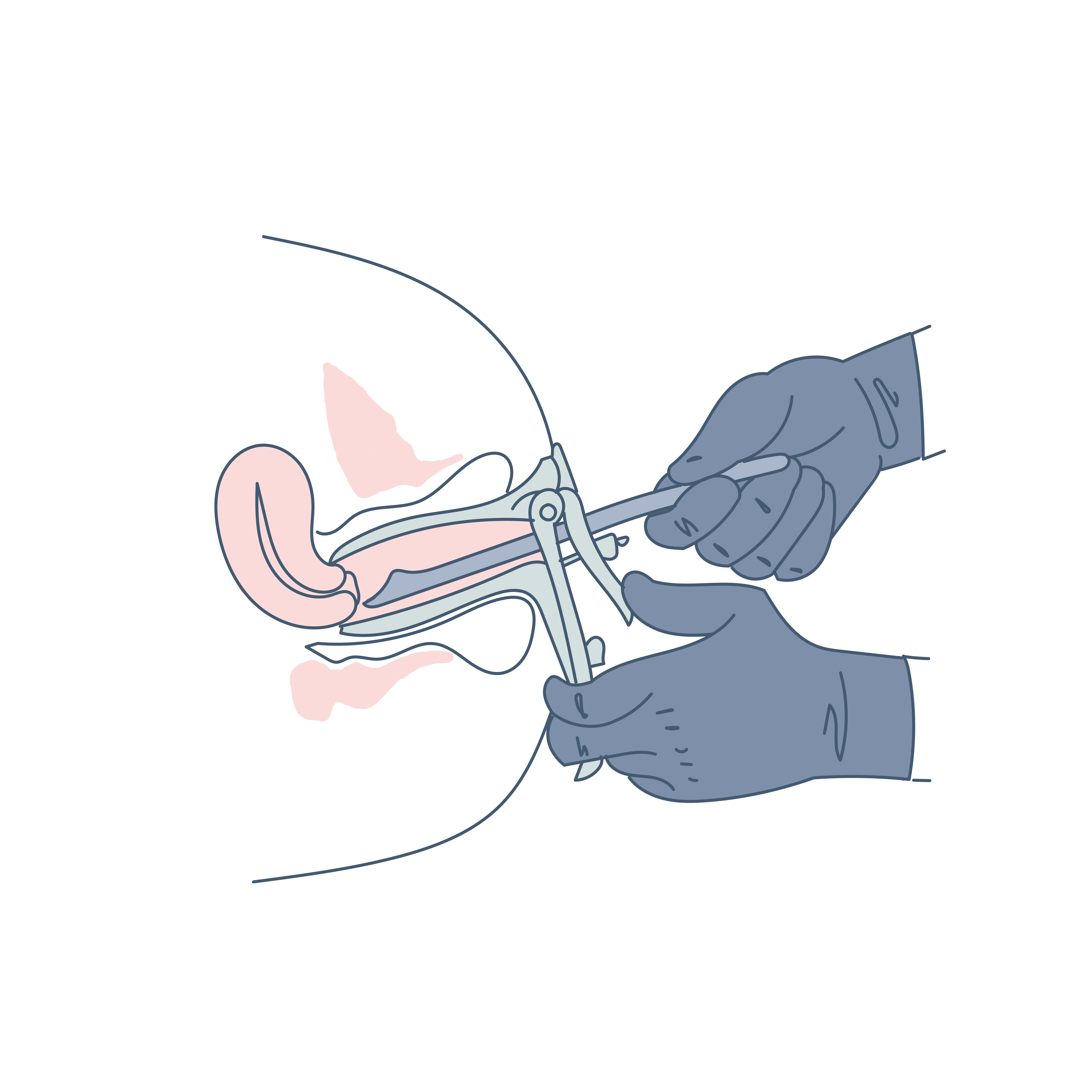 Getting a pap smear: Should you reschedule? Can you get a pap smear on your period?