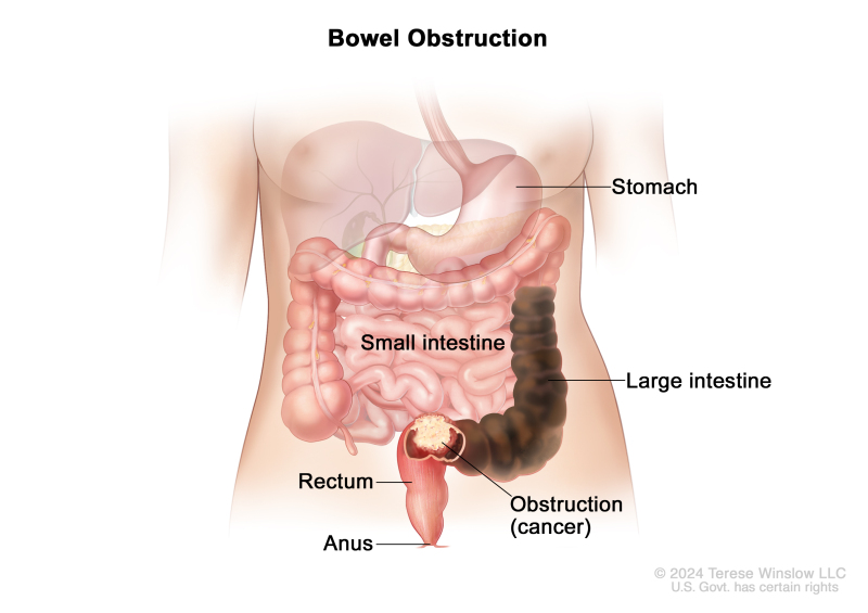 Does Imane Have Ovaries? Lets Clear Up the Confusion and Address This Question
