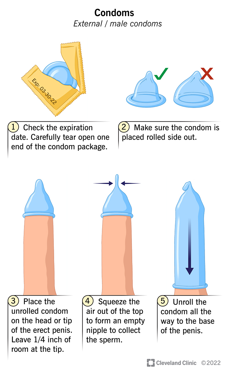 Can I Eat Whats in the Condom After? Health Risks?