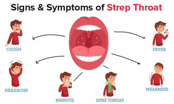 Strep Spanish Guide: How to Talk About Strep Throat Symptoms with Your Doctor.