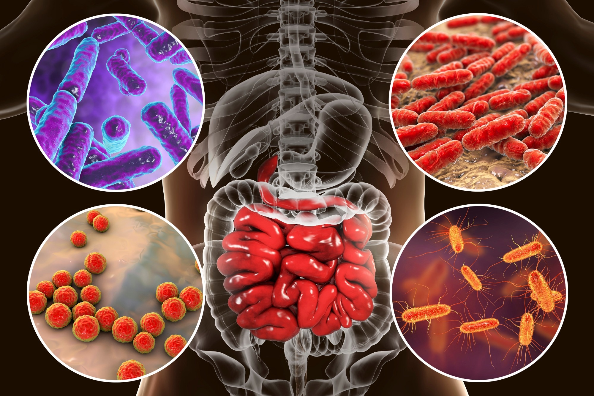 Is there any relationship between gut health and your skin condition? Explore this surprising body link now.