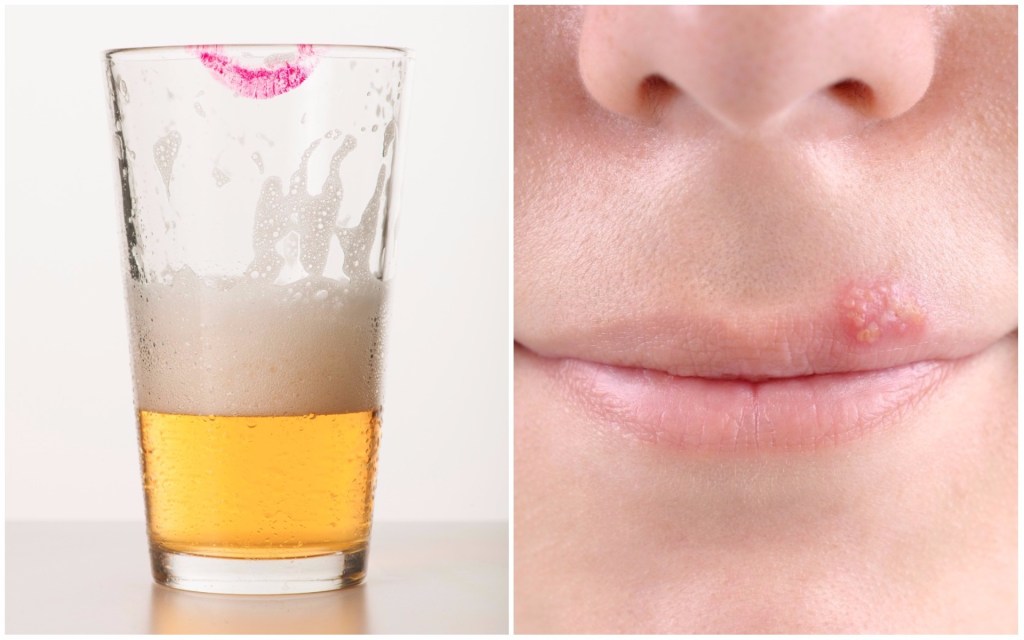 Smoking After Someone: Can You Really Catch Syphilis This Way?