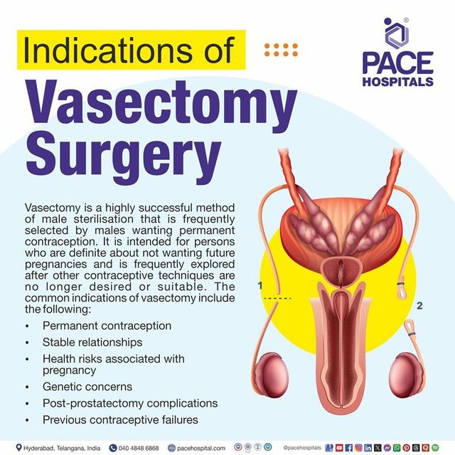 Need a Vasectomy? Who Does Vasectomy Near Me & Is Trusted?