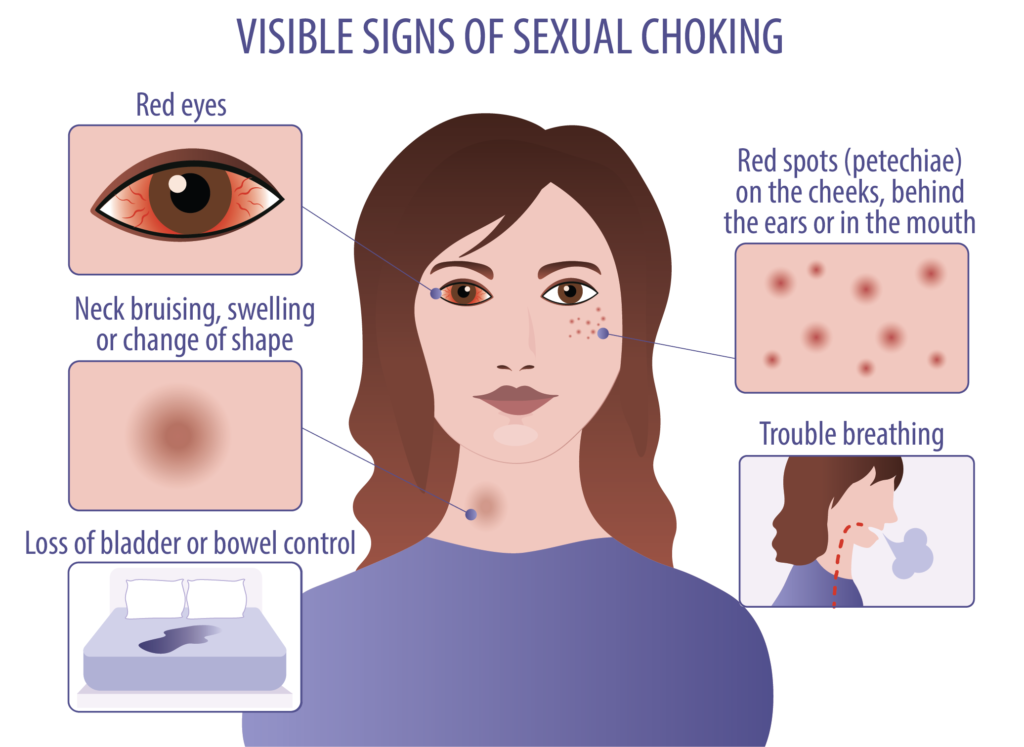 Figuring out how to choke someone sex? Prioritize safety and consent with these important guidelines first.