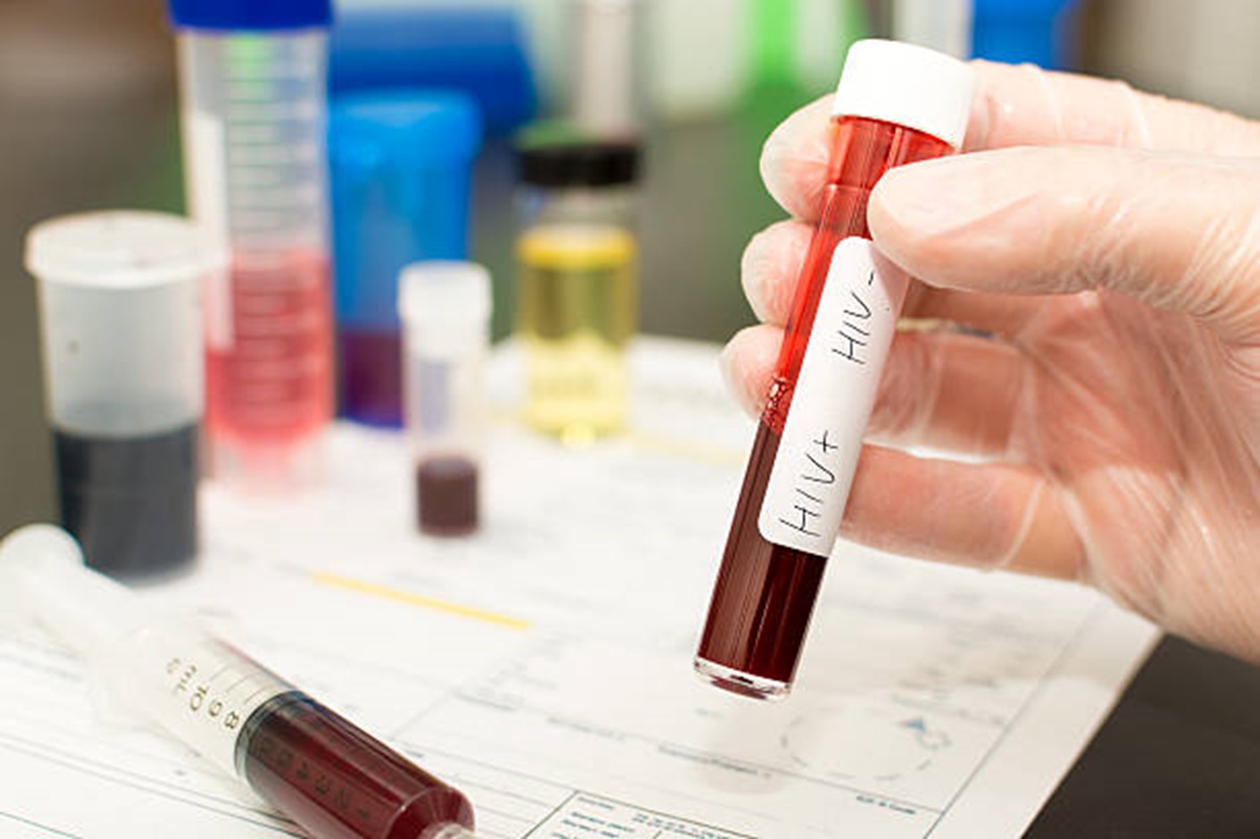 Can infections be found in sperm? See how can semen samples can be tested for STIs and what is detected.