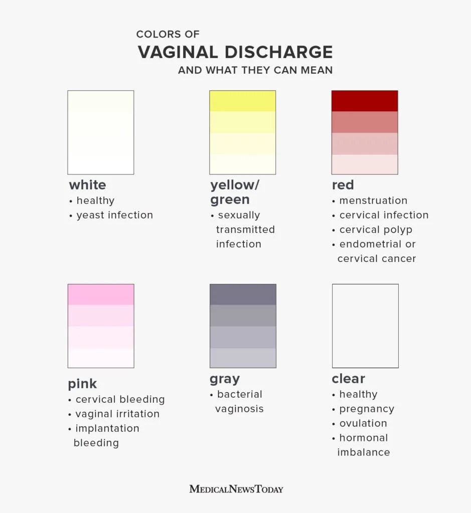 Why do I have creamy white discharge without odor? Learn what it means and if it is normal.