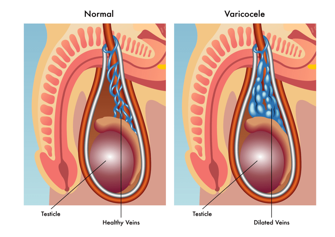 Vibration testicule explained simply: What does this unusual body sensation actually mean for you?