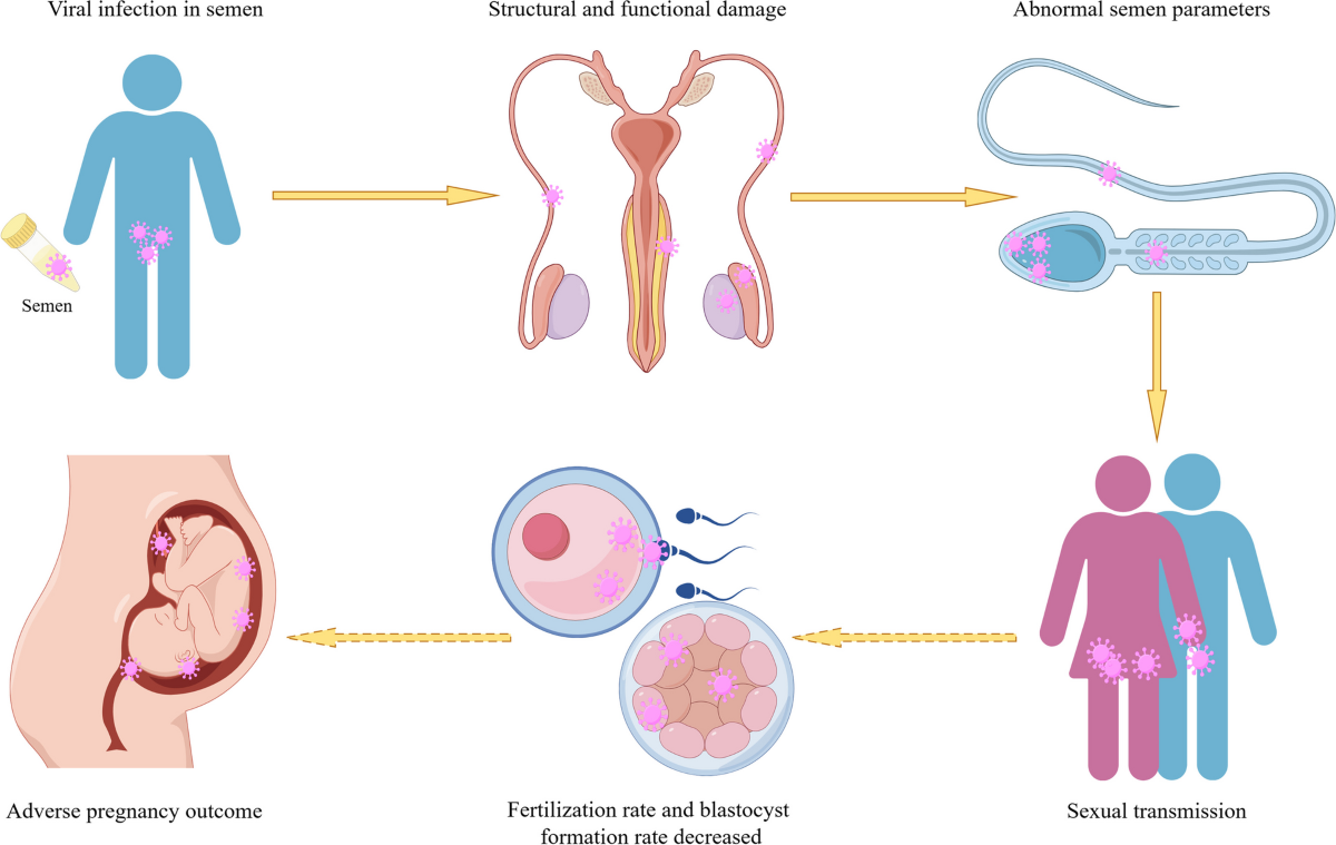 Can infections be found in sperm? See how can semen samples can be tested for STIs and what is detected.