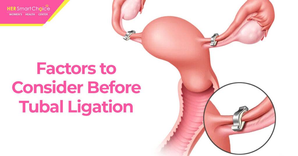 Tubal Ligation vs Hysterectomy: Pros and Cons to Consider (Helping You Make an Informed Health Choice)