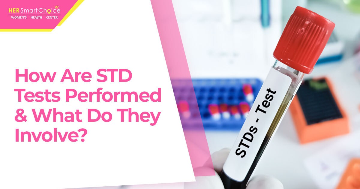 Why should you get free STD testing Van Nuys? It is an easy way to protect your health.