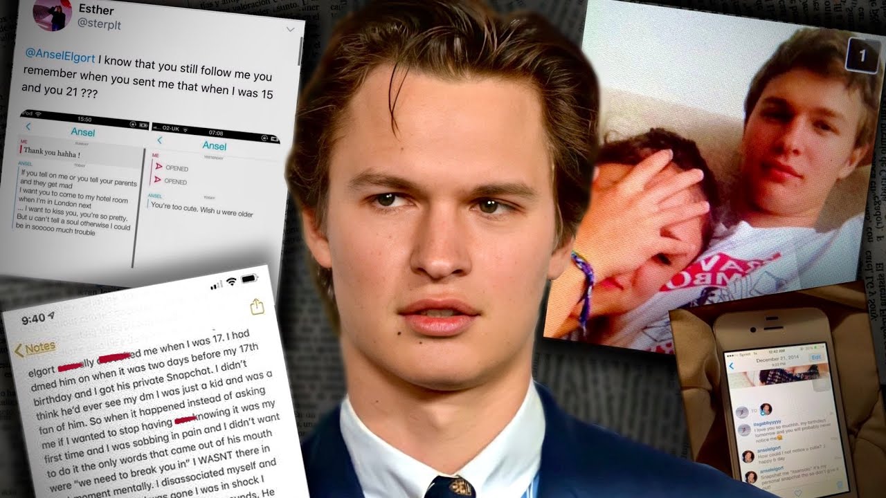 What is Ansel Elgort Syndrome? A simple and clear guide to understanding this condition and its basics.