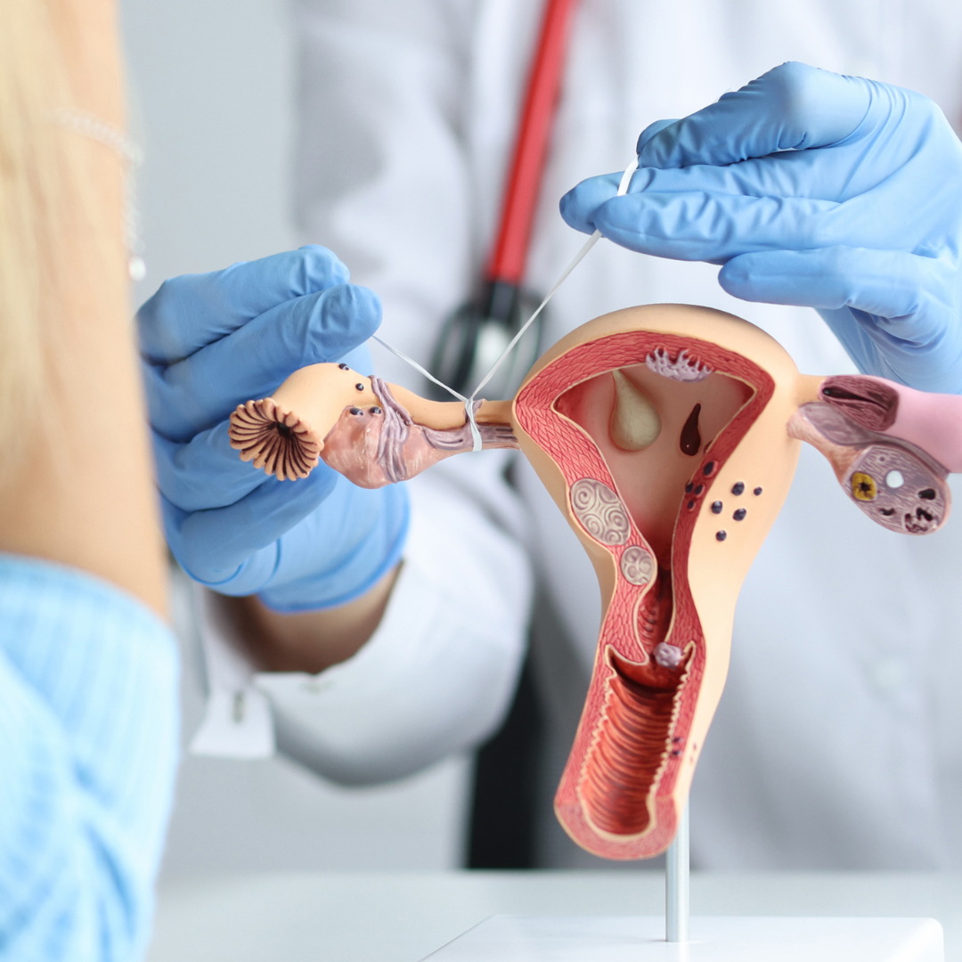 Tubal Ligation vs Hysterectomy: Pros and Cons to Consider (Helping You Make an Informed Health Choice)